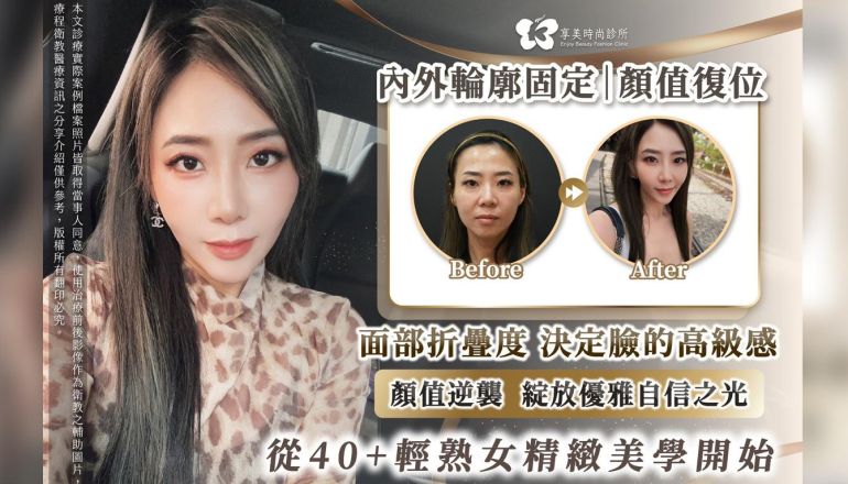 輕熟女精緻美學｜優雅與緊緻撫痕 鑄就凍齡之美