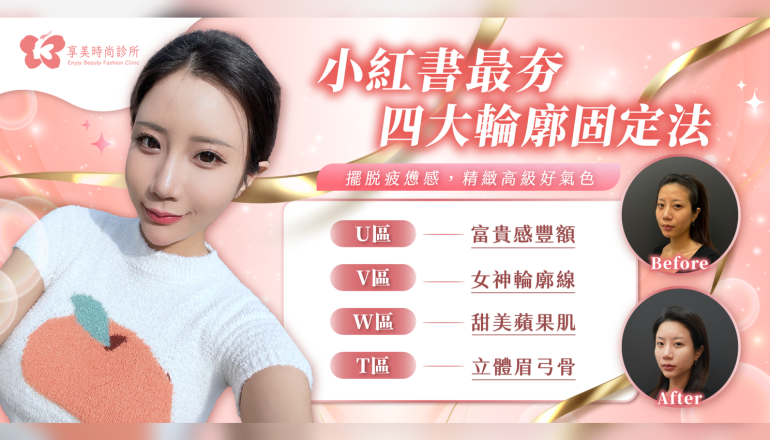 訂製專屬你的黃金比例｜四大輪廓固定打造無痕精緻美學