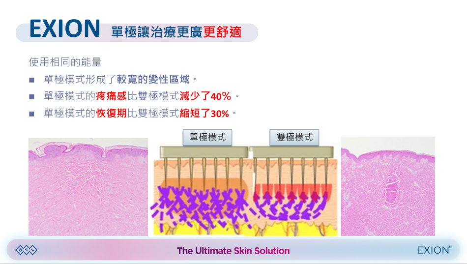 EXION介紹 (5)