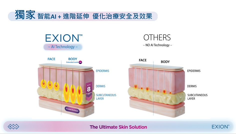 EXION介紹 (10)