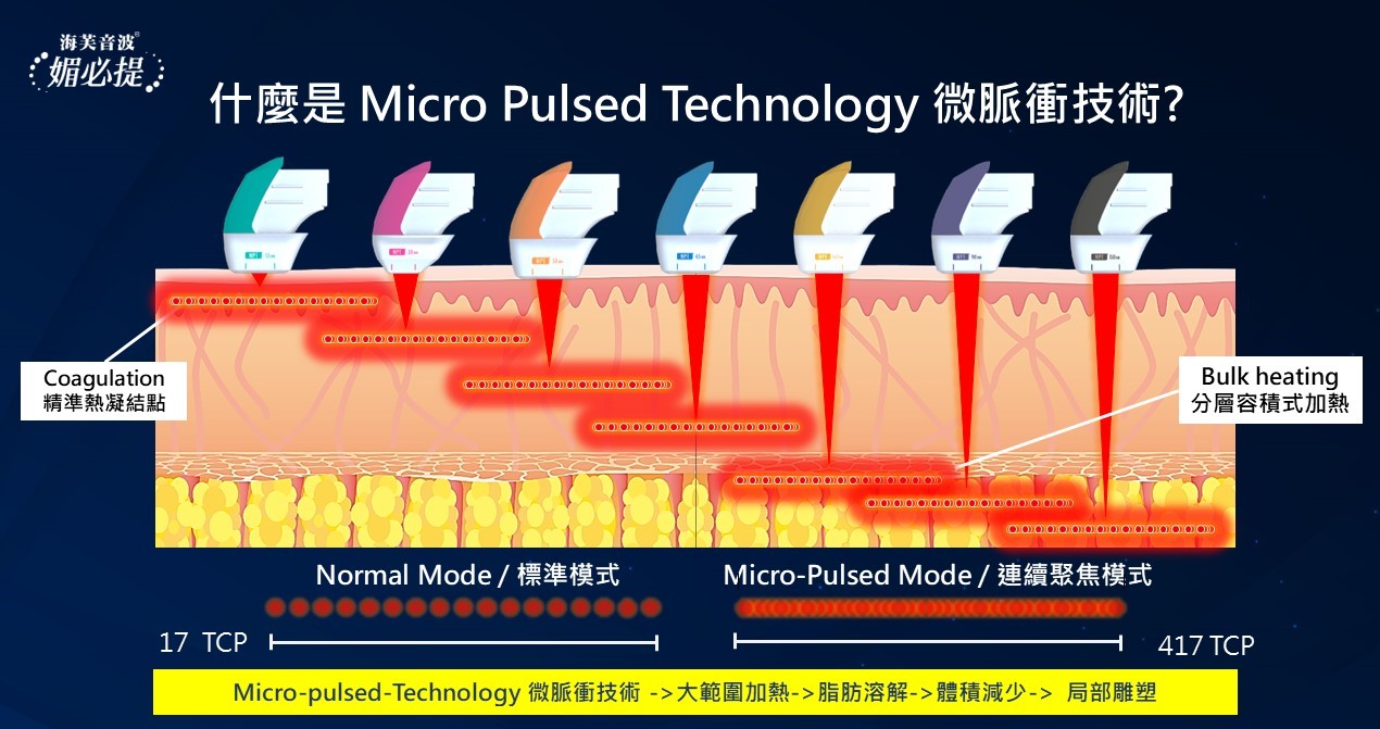 海芙音波媚必提-探頭聚焦示意(1)